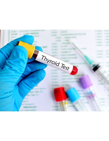 Thyroid Function Tests  T3-T4-TSH (THY)