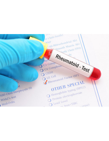 RHEUMATOID FACTOR (RF) (THY)