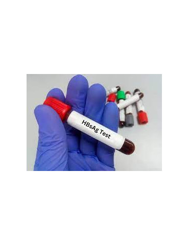 HEPATITIS B SURFACE ANTIGEN(HBSAG) RAPID TEST (THY)