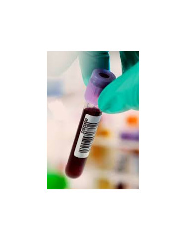 HEPATITIS C VIRUS (HCV) QUALITATIVE PCR (THY)
