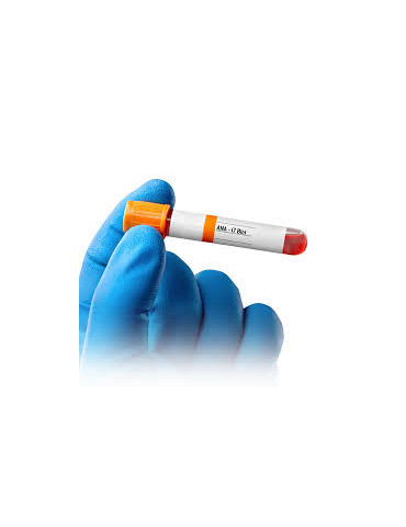 ANTINUCLEAR ANTIBODIES-17 BLOT (THY)