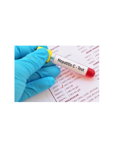 HEPATITIS C VIRUS - IGG (THY)