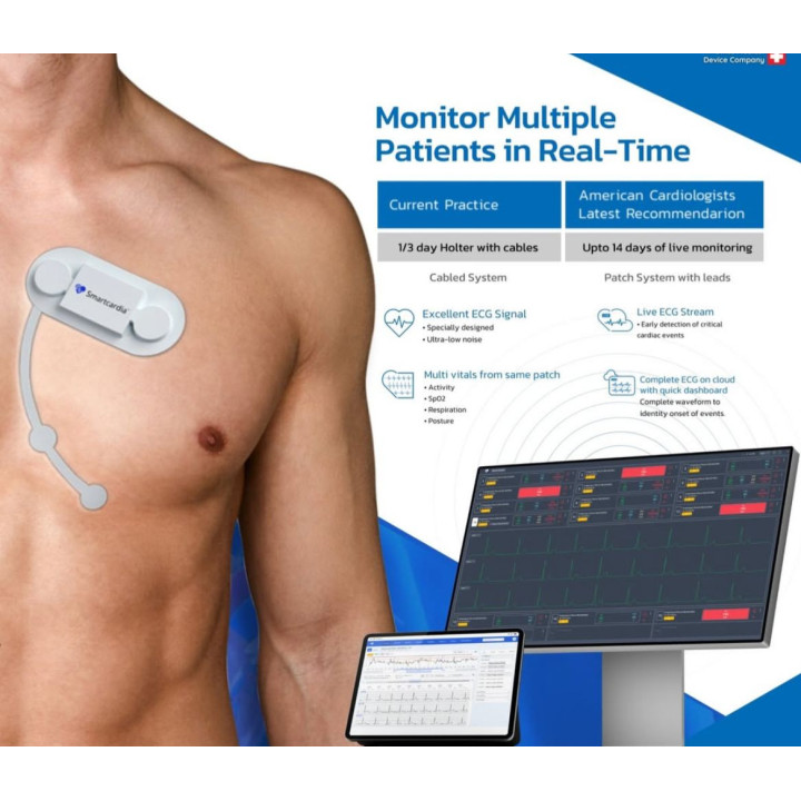 5-Day Holter Monitor — At-Home ECG