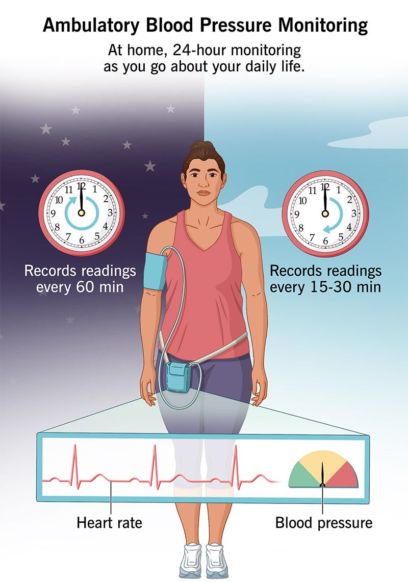 Top FAQs About ABPM Tests | ABPM at Home for Hypertension Monitoring