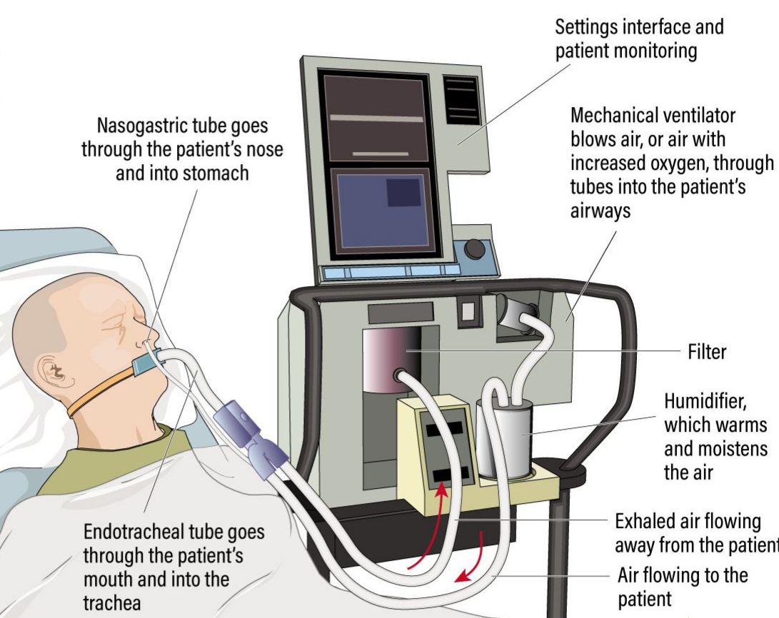 Working of a Ventilator